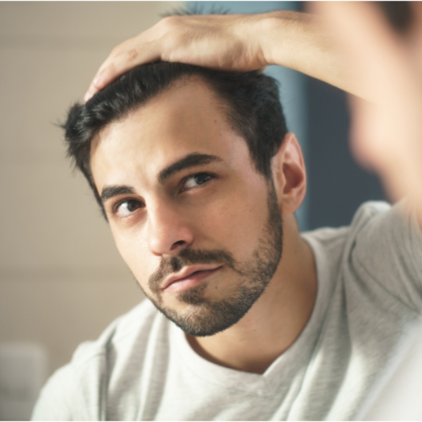 3 segnali che preannunciano perdita capelli uomo con stempiatura